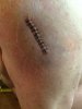 stitches.JPG