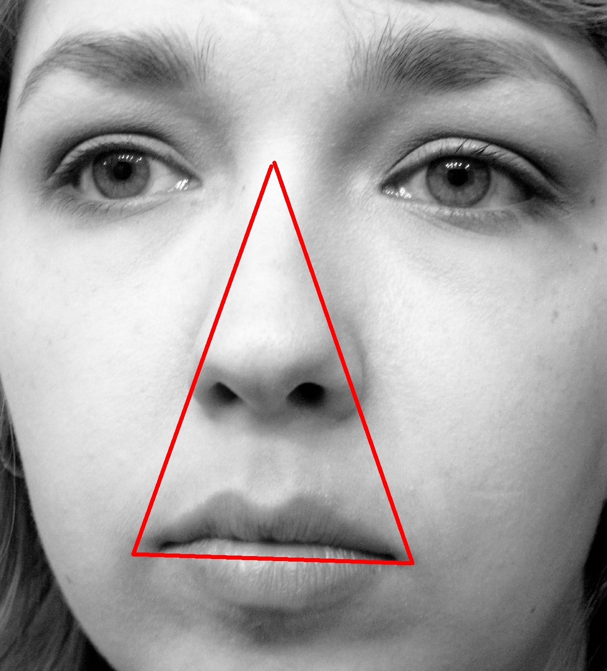 Danger_triangle_of_the_face_diagram.jpg